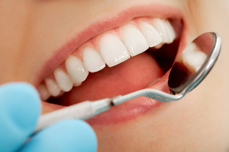 درمان سیاهی دندان ها