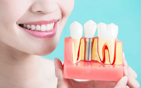 درمان ترمیمی دندان ها-نعمت الهی