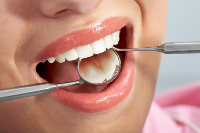 مزایای کامپوزیت دندان-نعمت الهی 