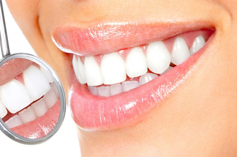 سفید کردن دندان ها در خانه-نعمت الهی