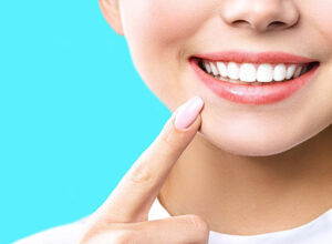روش های بلیچینگ دندان-نعمت اللهی