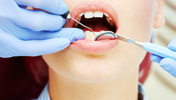 درمان عوارض کیست دندان-نعمت الهی