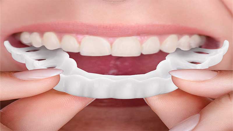 لمینت متحرک دندان چیست؟