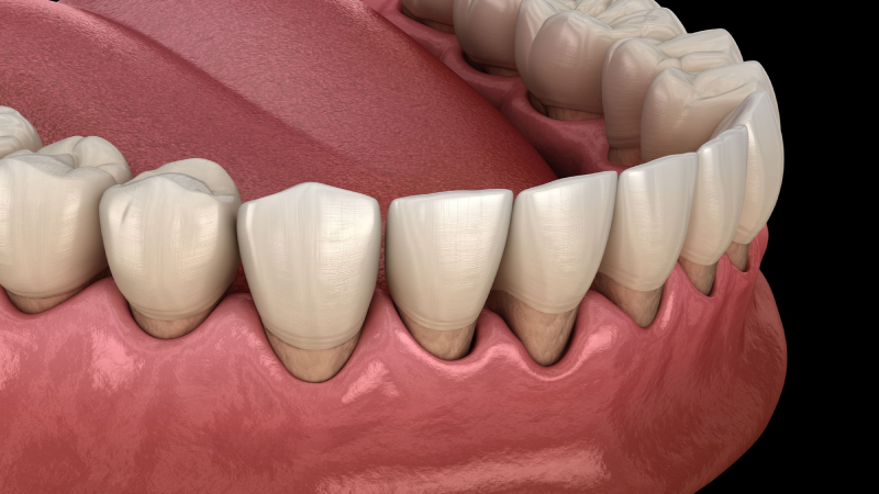 عکس جراحی دندان
