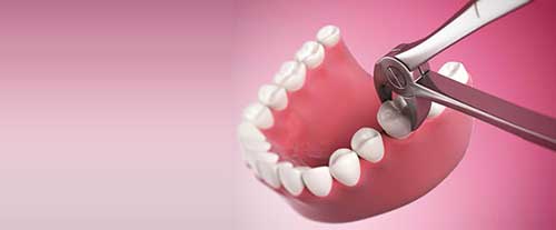 دلایل و عوارض کشیدن دندان چیست و هزینه ی آن چقدر است؟