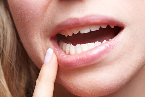 درمان عفونت دندان 