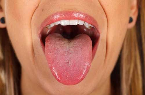 نحوه تشخیص سرطان دهان