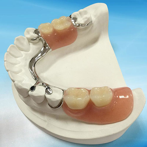 دندان مصنوعی تکه ای