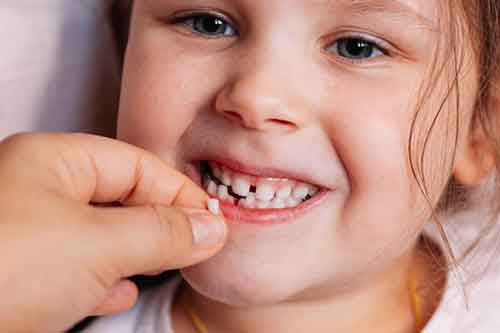 زمان کشیدن دندان در کودکان