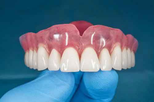 لاینر دندان مصنوعی