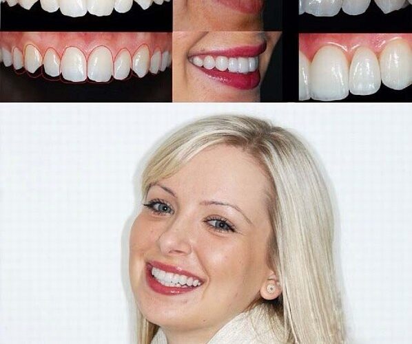 اصلاح فرم دندان