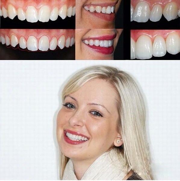اصلاح فرم دندان