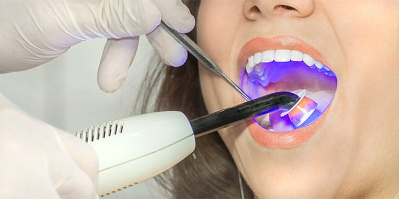 دندان پزشکی با لیزر