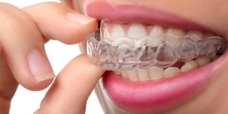 محافظ دندان و کاربردهای آن