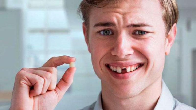 افتادن دندان - خارج شدن دندان از جای خود - بیرون افتادن دندان