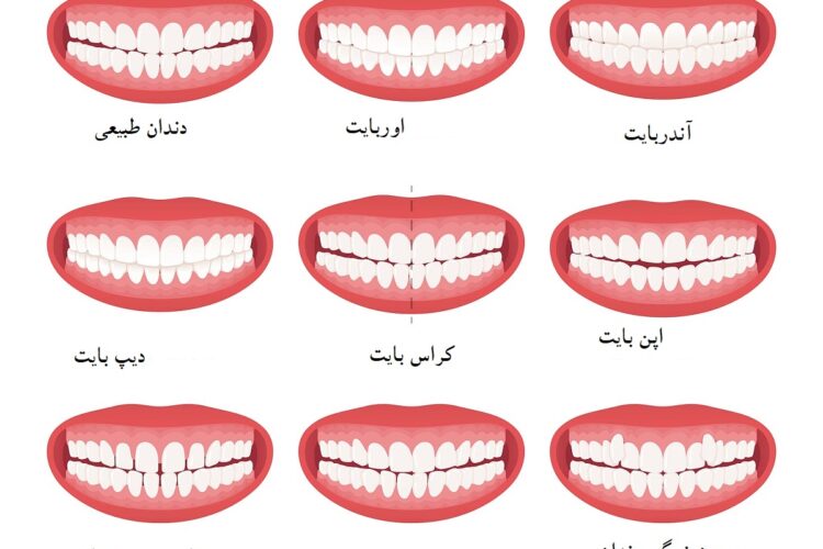 بایت های دندانی مفاهیم اساسی در زمینه ارتودنسی هستند که به نحوه ترازبندی و هماهنگی دندان‌ها و فک‌ها اشاره دارد.