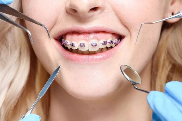 تفاوت دندانپزشک با ارتودنتیست