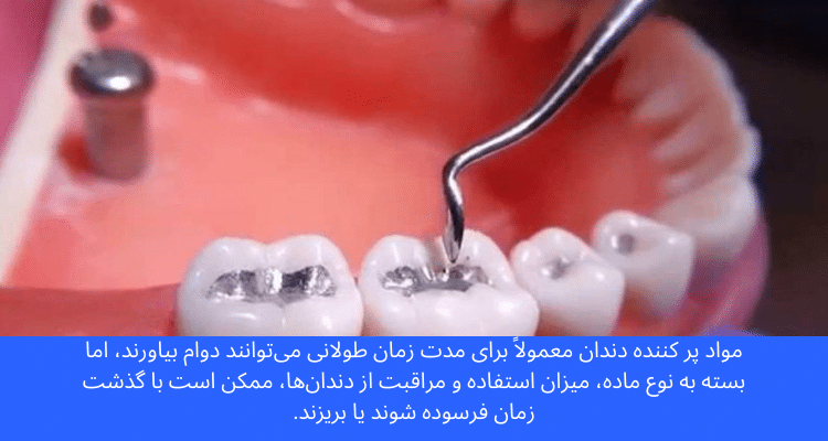 چه زمانی مواد پر کردن دندان باید تعویض شود؟ زمان تعویض مواد پر کردن دندان