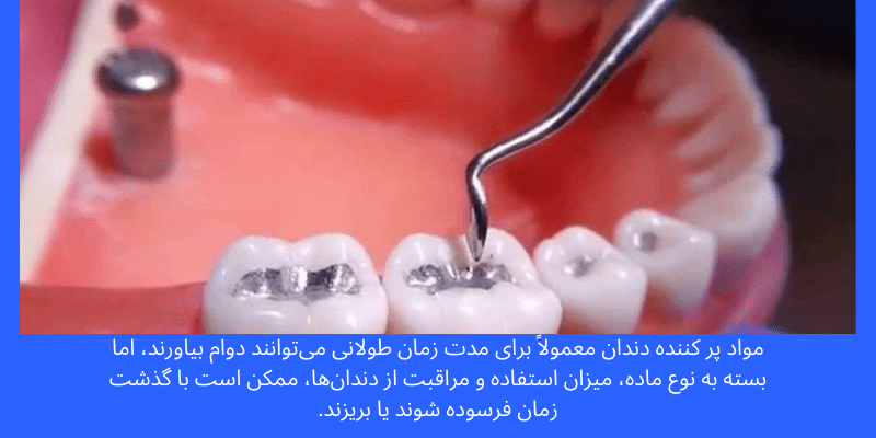 چه زمانی مواد پر کردن دندان باید تعویض شود؟ زمان تعویض مواد پر کردن دندان