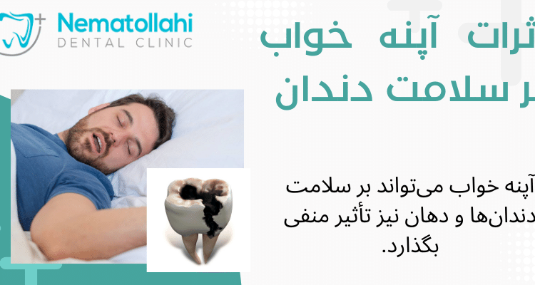 اثرات آپنه خواب بر سلامت دندان