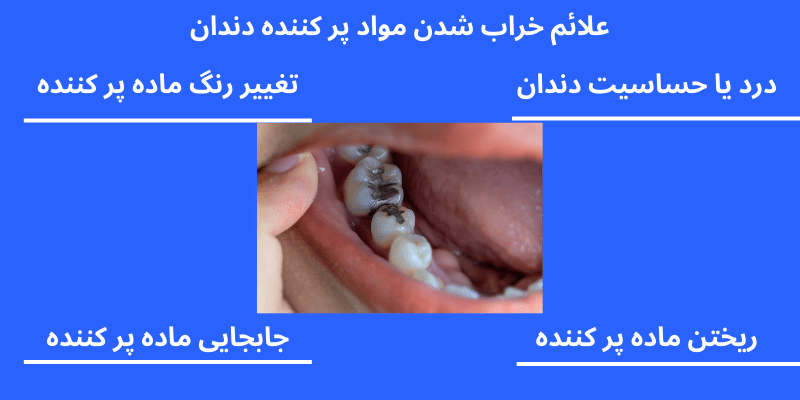 علائم خراب شدن مواد پر کننده دندان