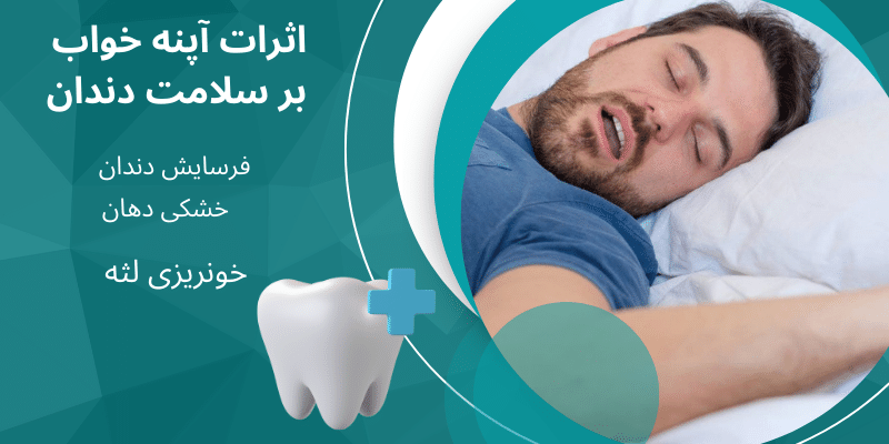 چگونه آپنه خواب به دندان‌ها آسیب می‌رساند؟