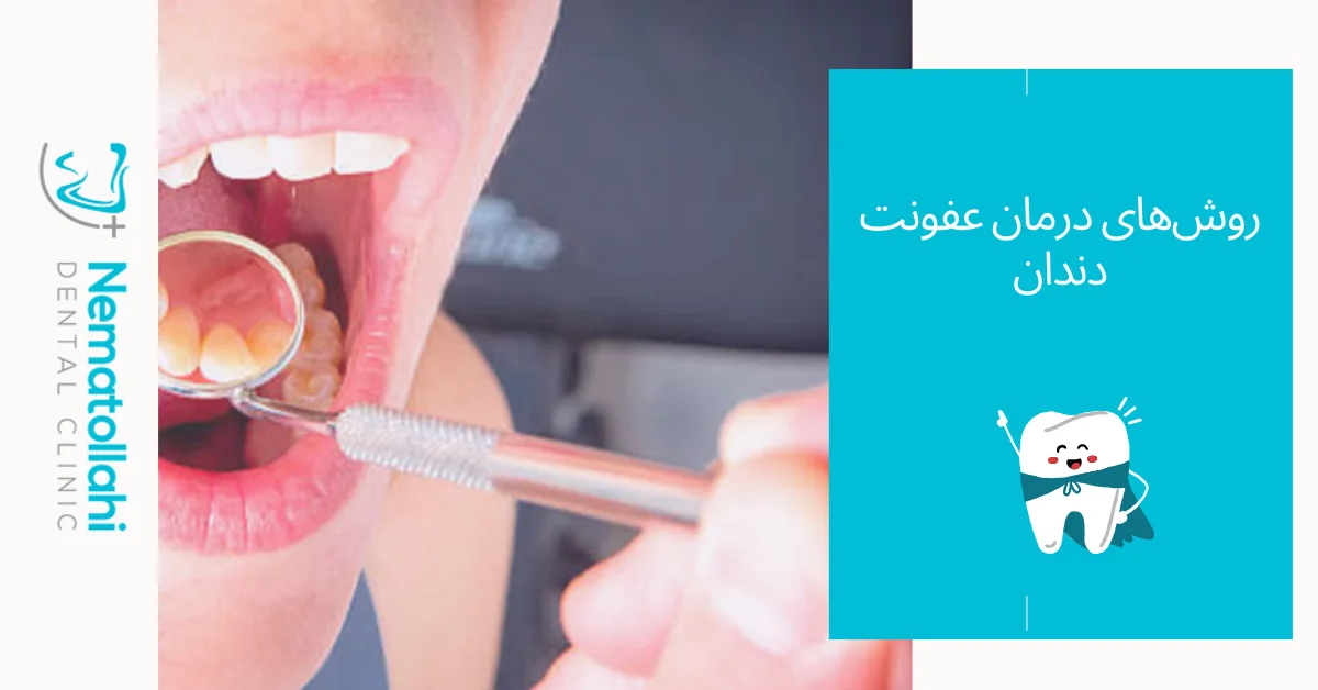 روش‌های درمان عفونت دندان