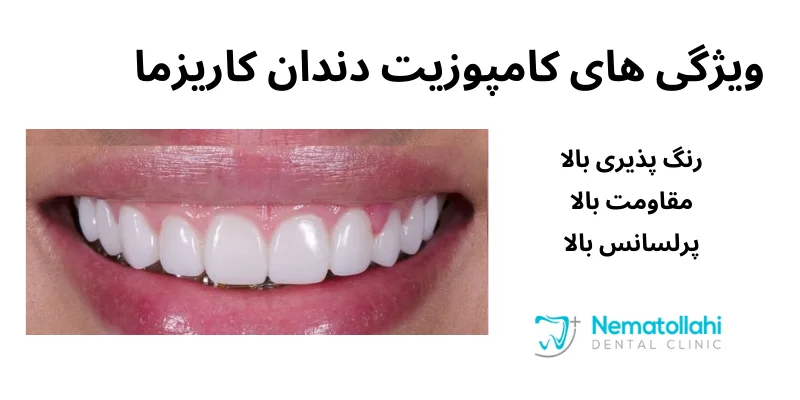 ویژگی های کامپوزیت دندان کاریزما