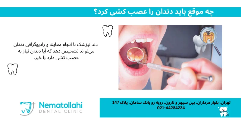 چگونه عصب کشی دندان انجام می‌شود؟