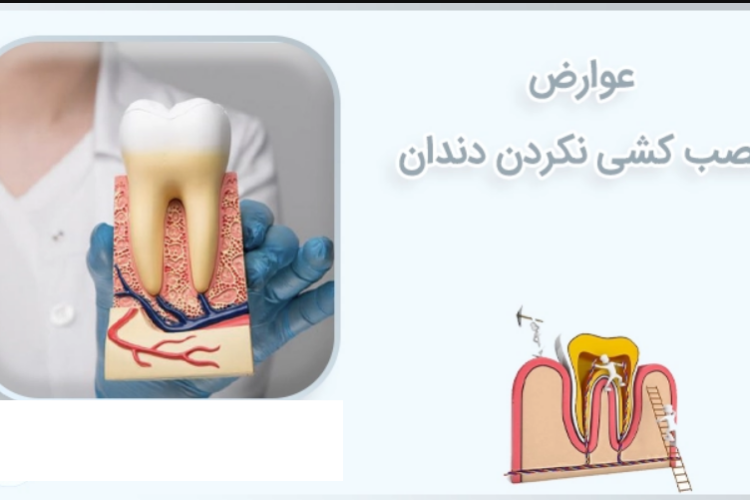 عواقب عصب کشی نکردن دندان