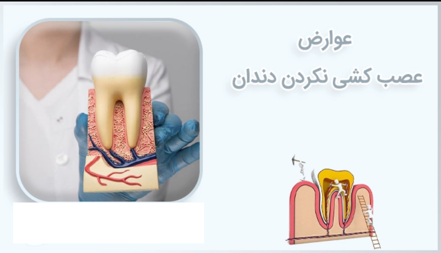 عواقب عصب کشی نکردن دندان