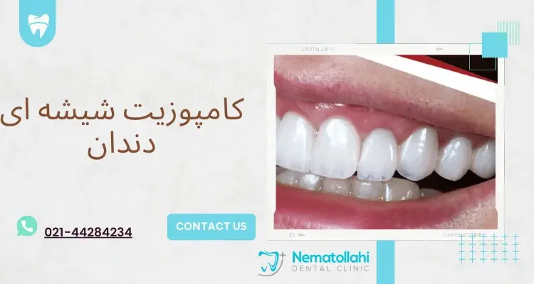 کامپوزیت شیشه ای دندان (2)