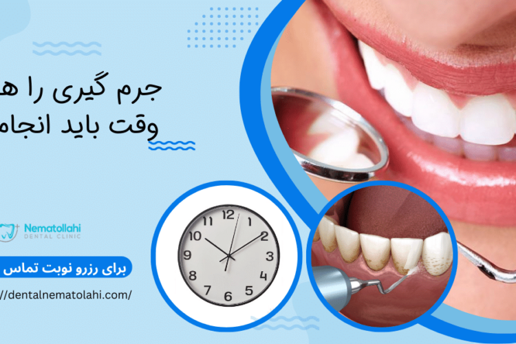 جرم گیری را هر چند وقت باید انجام داد؟