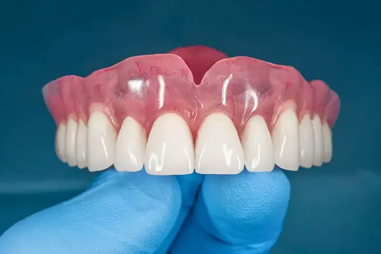 دندان مصنوعی برای لثه های تحلیل رفته
